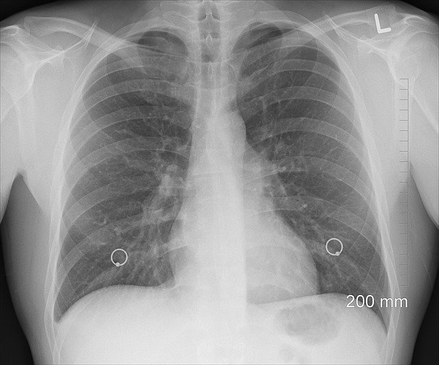 ブラジリアン柔術で肋骨の怪我から身を守る5つの方法 柔術b